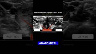 The Jugular vein an anatomical landmark for the common carotid artery medicine vascularhealth [upl. by Kubetz]