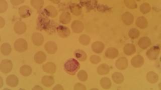 Plasmodium vivax gametocyte stage [upl. by Lynsey640]