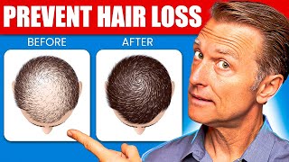 12 Proven Remedies to Prevent Hair Loss and Regrowth Regrow hair [upl. by Laurene]