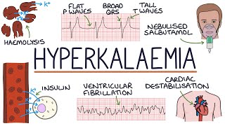 Understanding Hyperkalaemia High Potassium [upl. by Olivann274]