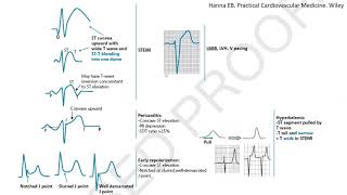 ST elevation on ECG part 1 Differential diagnosis and case studies STEMI mimickers subtle STEMI [upl. by Spiegel463]