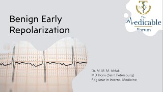 Benign Early Repolarization  ECG [upl. by Greenstein290]