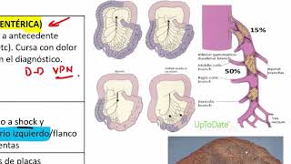 3 ABDOMEN AGUDO VASCULAR [upl. by Adelia]