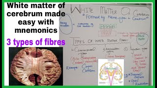 White Matter Of CerebrumTypes Of White matter Fibers CommissuralAssociation amp Projection Fibers [upl. by Anotal]