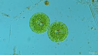 Euglena Encystment  A Rarely Seen Event [upl. by Atterg501]