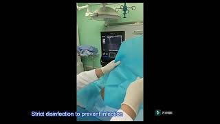 Ultrasoundguided approach for puncturing dorsal root ganglion – Video abstract 479986 [upl. by Airod471]