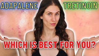 Adapalene vs Tretinoin  Which Is The Best ANTIACNE and ANTIAGING Ingredient [upl. by Booze]