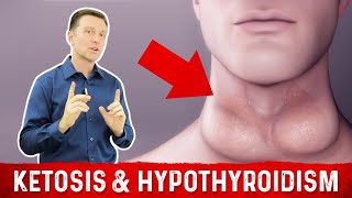 Does Ketosis Cause Hypothyroidism – DrBerg [upl. by Ilac]