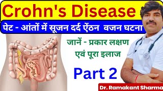 Crohns Disease A Comprehensive Guide to Diagnosis and Managementdrramakantsharma7 [upl. by Avilla971]