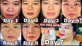 KIREI GLUTATHIONE REVIEW  ACTUAL RESULT REVEALED [upl. by Ttcos]