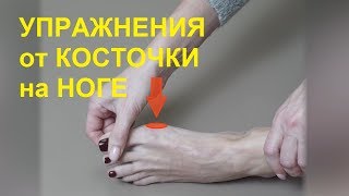 Упражнения от косточки на ноге гимнастика для лечения большого пальца ноги [upl. by Burris]