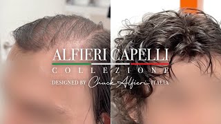 Chuck Alfieri Capelli Hair Replacement for Men 111024 BEST DENSITY [upl. by Tipton]