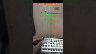 Erythrocyte sedimentation rate ll ESR TEST PROCEDURE AND NORMAL RANGE short [upl. by Freiman]