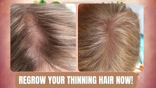 Potent Hair Growth Tea Regrow Lost Hair In 30 Days [upl. by Wauters]