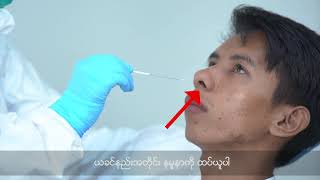 Sample Collection Oropharyngeal Swab amp Nasopharyngeal Swab [upl. by Lucius]