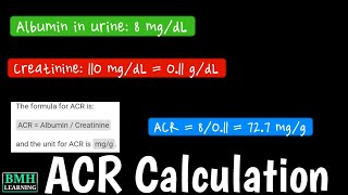 Calculation Of Urine ACR  Urine ACR Test [upl. by Annovoj]