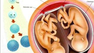 Everything You Need To Know About Fraternal and Identical Twins  Dr Sarah Finch [upl. by Reh]