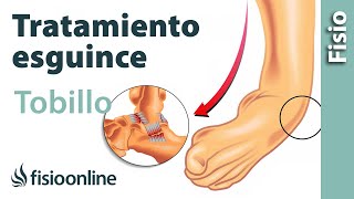 Tratamiento osteopático del esguince de tobillo [upl. by Desiree]