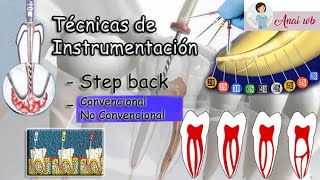 ENDODONCIA  Técnicas de Instrumentación Step Back  Convencional  No Convencional  PARTE 1 [upl. by Fitzhugh]