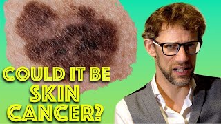 How To Check For Melanoma In 5 Easy Steps  Skin Cancer Assessment  Dr Gill [upl. by Barkley]