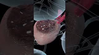 Prostate Cancer Explained Animation [upl. by Ximenes]