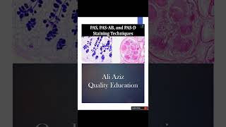 PAS PAS AB and PAS D Staining Techniques  Ali Aziz Quality Education [upl. by Ivz613]