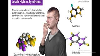 Lecture 40  Biometabolism  Disorders of Purine and Pyrimidine Metabolism [upl. by Ennasor718]