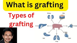 tissue graftinggraftingwhat is graftingtypes of graftingautograftisograftallograftxeno [upl. by Assirrec920]