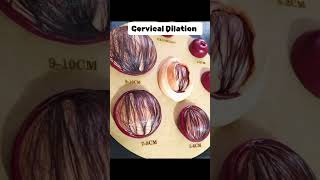 Cervical Dilation cervix cervical pregnant midwife [upl. by Demetra]