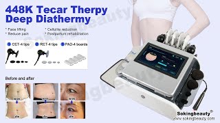 448khz tecar therapy machine  sokingbeauty [upl. by Inittirb248]