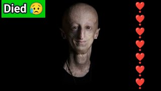 Survivor of rare rapidageing disease progeria dies at 28sammy basso fidanzata sammy basso età [upl. by Tacklind790]