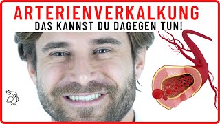 ✅ARTERIENVERKALKUNG ENTFERNEN✅ 8 Tipps um deine Arterien zu reinigen – Arteriosklerose vorbeugen [upl. by Pani]