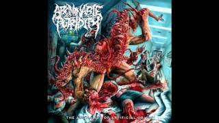 Abominable Putridity  The Anomalies Of Artificial Origin Remixed amp Remastered 2015 FULL ALBUM [upl. by Jeffry]