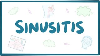 Sinusitis  causes symptoms diagnosis treatment pathology [upl. by Ever126]