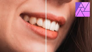 How to Whiten the Teeth in Affinity Photo [upl. by Nalliuq]