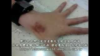 樂活皂世界之見證者鄭先生見證使用手工皂前後情形20130508 [upl. by Oremar559]