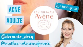 Live Dermato Drey et Avène  acné de ladulte boutons quotimperfectionsquot [upl. by Purity]