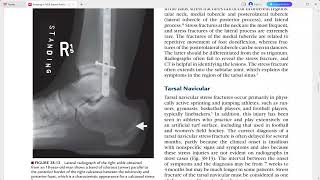 RADIOLOGY EXAM CASES [upl. by Bergstrom188]