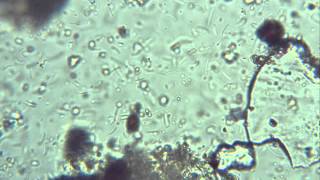 Microbe Maker Compost Tea Under the Microscope [upl. by Sclar490]