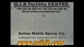 active motile sperm 1 sluggish motile 50 videolow sperm count video [upl. by Nylarahs795]