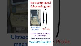 Transesophageal echocardiogram [upl. by Attegroeg]