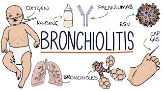 Understanding Bronchiolitis [upl. by Oremor]