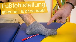 Fußfehlstellung erkennen amp korrigieren Übungen 👣Knickfuß Senkfuß Spreizfuß [upl. by Euridice]