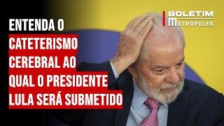 Entenda o cateterismo cerebral ao qual o presidente Lula será submetido [upl. by Nilrak]