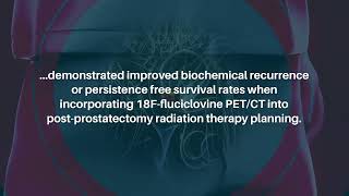 AIAssisted Lesion Segmentation in PETCT for Prostate Cancer Radiation Therapy  Oncoscience [upl. by Castillo]