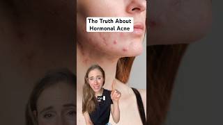 Hormonal Acne Is A Mixed Bag  Heres What You Need To Know dermatologist [upl. by Brunell]