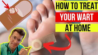 Doctor explains how to treat WARTS at home plus when to seek medical attention [upl. by Peggy953]