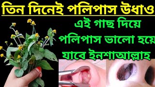 এই গাছ চিনে রাখুন নাকের পলিপাস ভালো করে দিচ্ছে। [upl. by Hennebery]