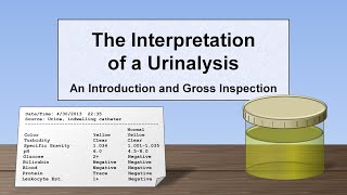 Interpretation of the Urinalysis Part 1  Introduction and Inspection [upl. by Dnalloh]