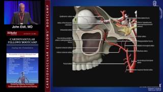 Neurovascular Anatomy Physiology and Carotid Imaging John Eidt MD [upl. by Mcferren885]